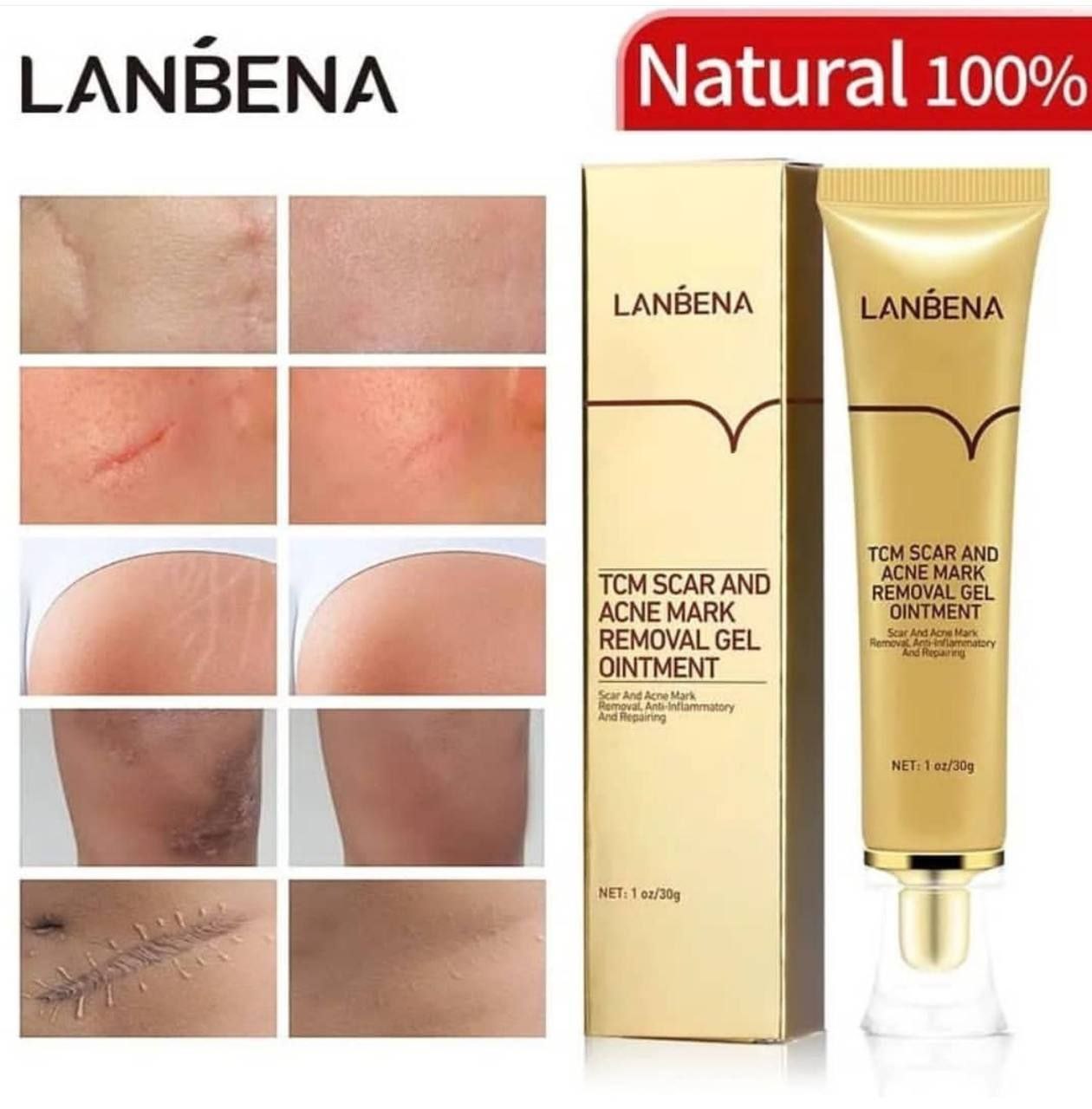 ژل ترمیم کننده جای زخم و آکنه LANBENA